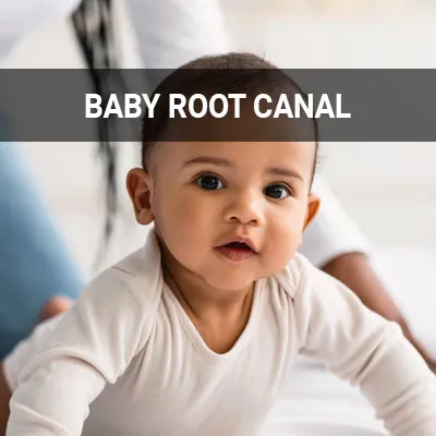 Visit our Baby Root Canal page