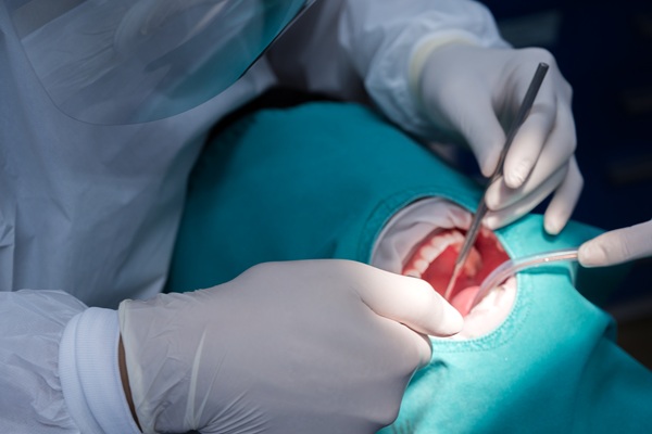 When Is Endodontic Surgery Recommended?