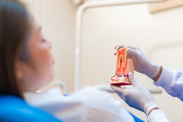 Root Canal Recovery: What To Expect After Undergoing Therapy